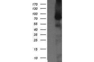 Image no. 1 for anti-NIMA (Never In Mitosis Gene A)-Related Kinase 11 (NEK11) antibody (ABIN1499682) (NEK11 Antikörper)
