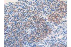 IHC-P analysis of Mouse Ovary Tissue, with DAB staining. (MGST1 Antikörper  (AA 8-155))