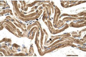 Human Muscle; FICD antibody - C-terminal region in Human Muscle cells using Immunohistochemistry (FICD Antikörper)