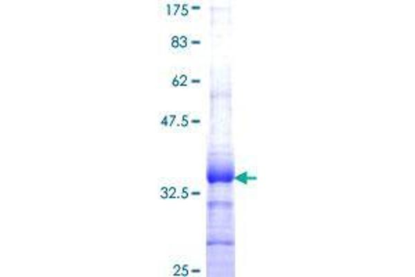 SLURP1 Protein (AA 25-102) (GST tag)