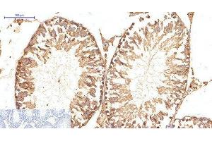Immunohistochemistry of paraffin-embedded Rat testis tissue using ATG5 Monoclonal Antibody at dilution of 1:200. (ATG5 Antikörper)