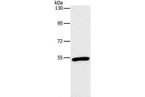 Western Blot analysis of Mouse heart tissue using OXTR Polyclonal Antibody at dilution of 1:866 (Oxytocin Receptor Antikörper)
