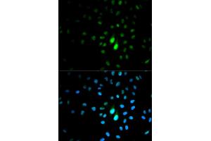 Immunofluorescence analysis of MCF-7 cells using PIN1 antibody. (PIN1 Antikörper)