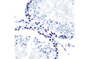 Immunohistochemistry of paraffin-embedded rat testis using mSin3A Rabbit mAb (ABIN7270318) at dilution of 1:100 (40x lens). (SIN3A Antikörper)