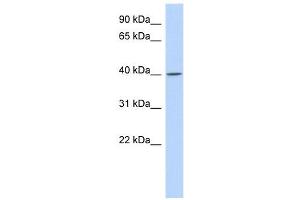 C11ORF65 antibody used at 1 ug/ml to detect target protein. (C11orf65 Antikörper  (N-Term))