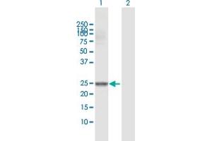 Western Blot analysis of GSTM4 expression in transfected 293T cell line by GSTM4 MaxPab polyclonal antibody. (GSTM4 Antikörper  (AA 1-218))