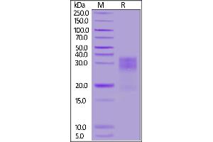 Human MUC-17, His Tag on  under reducing (R) condition. (MUC17 Protein (AA 4131-4390) (His tag))