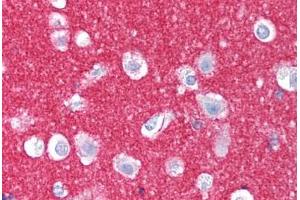 Human Brain, Cortex (formalin-fixed, paraffin-embedded) stained with NCAM1 antibody ABIN239829 at 10 ug/ml followed by biotinylated anti-mouse IgG secondary antibody ABIN481714, alkaline phosphatase-streptavidin and chromogen. (CD56 Antikörper)