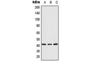 Western blot analysis of CRK expression in HeLa (A), K562 (B), NIH3T3 (C) whole cell lysates. (Crk Antikörper  (Center))
