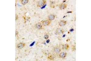 Immunohistochemical analysis of PACAP-R1 staining in human brain formalin fixed paraffin embedded tissue section. (ADCYAP1R1 Antikörper)