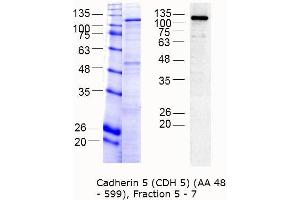 Western Blotting (WB) image for Cadherin 5 (CDH5) (AA 48-599) protein (MBP tag) (ABIN3090342)