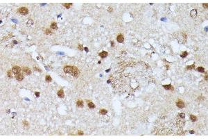 Immunohistochemistry of paraffin-embedded Mouse brain using KIAA1429 Polyclonal Antibody at dilution of 1:100 (40x lens). (VIRMA/KIAA1429 Antikörper)