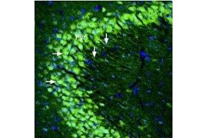 Immunohistochemistry (IHC) image for anti-Glutamate Receptor, Ionotropic, Kainate 5 (GRIK5) (AA 430-442), (Extracellular) antibody (ABIN7043241)