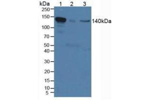 Western blot analysis of (1) Mouse Serum, (2) Mouse Placenta Tissue and (3) Human HeLa cells. (IL12RB2 Antikörper  (AA 285-441))