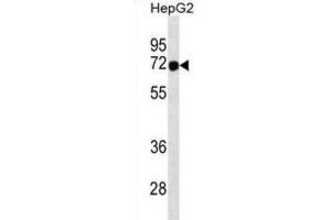 Western Blotting (WB) image for anti-Forkhead Box N3 (FOXN3) antibody (ABIN3000811) (FOXN3 Antikörper)