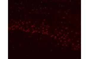 IF analysis of HnRNP H/HNRNPH1 using anti-HnRNP H/HNRNPH1 antibody (ABIN4886623).