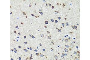 Immunohistochemistry of paraffin-embedded Mouse brain using CCDC124 Polyclonal Antibody at dilution of 1:100 (40x lens). (CCDC124 Antikörper)