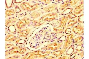 IHC image of ABIN7156316 diluted at 1:300 and staining in paraffin-embedded human kidney tissue performed on a Leica BondTM system. (OCRL Antikörper  (AA 121-271))