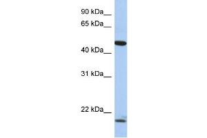 WB Suggested Anti-PLAGL1 Antibody Titration:  0. (PLAGL1 Antikörper  (N-Term))