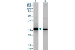 Western Blot analysis of HMGB2 expression in transfected 293T cell line by HMGB2 monoclonal antibody (M03), clone 3C7.