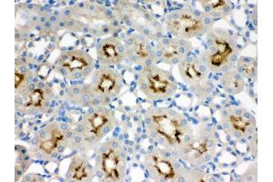 Immunohistochemistry (IHC) image for anti-Structural Maintenance of Chromosomes 3 (SMC3) (AA 1178-1216), (C-Term) antibody (ABIN3043343)