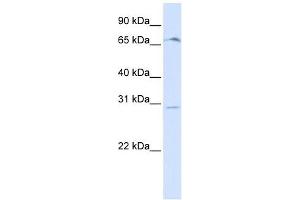 OR6C75 antibody used at 1 ug/ml to detect target protein.