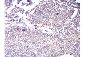 Immunohistochemistry (IHC) image for anti-GNAS Complex Locus (GNAS) (AA 42-188) antibody (ABIN5542322)
