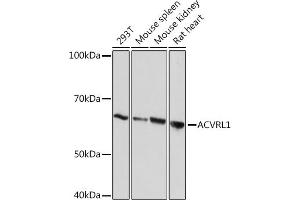 Western blot analysis of extracts of various cell lines, using  Rabbit mAb (ABIN7265412) at 1:1000 dilution. (ACVRL1 Antikörper)