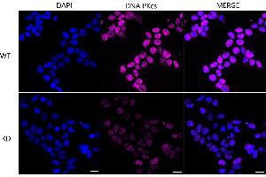 Immunocytochemical staining of Hela cells using DNA PKcs antibody (ABIN7800013), 1:1,000), Top panel: wild-type (WT), Bottom panal: DNA PKcs shRNA knockdown (KD). (Rekombinanter PRKDC Antikörper)