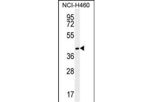 GGH Antibody (C-term) (ABIN655984 and ABIN2845368) western blot analysis in NCI- cell line lysates (35 μg/lane). (GGH Antikörper  (C-Term))