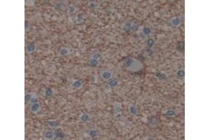 Used in DAB staining on fromalin fixed paraffin- embedded Kidney tissue (SCAND3 Antikörper  (AA 366-526))
