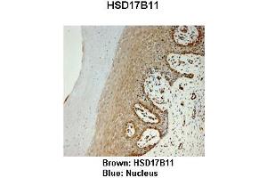 Sample Type :  Monkey vagina   Primary Antibody Dilution :   1:25   Secondary Antibody:  Anti-rabbit-HRP   Secondary Antibody Dilution:   1:1000   Color/Signal Descriptions:  Brown: HSD17B11 Blue: Nucleus   Gene Name:  HSD17B11   Submitted by:  Jonathan Bertin, Endoceutics Inc. (HSD17B11 Antikörper  (N-Term))
