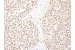 Immunohistochemistry (IHC) image for anti-WD Repeat Domain 5 (WDR5) (AA 1-50) antibody (ABIN7454448)