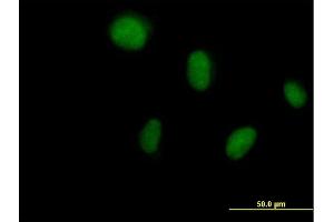 Immunofluorescence of purified MaxPab antibody to DCK on HeLa cell. (DCK Antikörper  (AA 1-260))