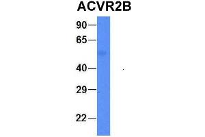 Western Blotting (WB) image for anti-Activin A Receptor, Type IIB (ACVR2B) (Middle Region) antibody (ABIN2782110)