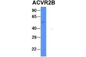 Host:  Rabbit  Target Name:  FAM46C  Sample Type:  Human Fetal Liver  Antibody Dilution:  1.