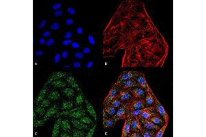 Immunocytochemistry/Immunofluorescence analysis using Mouse Anti-CD74 Monoclonal Antibody, Clone 6D9 . (CD74 Antikörper  (AA 1-100) (Atto 594))