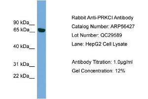 WB Suggested Anti-PRKCI  Antibody Titration: 0. (PKC iota Antikörper  (Middle Region))