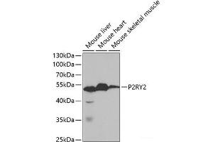 Western blot analysis of extracts of various cell lines using P2RY2 Polyclonal Antibody at dilution of 1:1000.