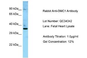 Host: Rabbit Target Name: DMC1 Sample Type: Fetal Heart Antibody Dilution: 1. (DMC1 Antikörper  (N-Term))