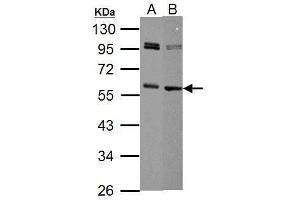 Western Blotting (WB) image for anti-Myc Proto-Oncogene protein (MYC) (Center) antibody (ABIN2855631)