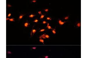 Immunofluorescence analysis of C6 cells using GTF3C4 Polyclonal Antibody at dilution of 1:100 (40x lens). (GTF3C4 Antikörper)