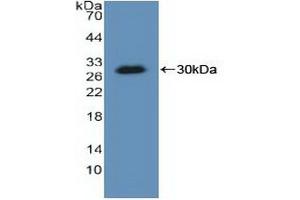 Detection of Recombinant KARS, Human using Polyclonal Antibody to Lysyl tRNA Synthetase (KARS) (KARS Antikörper  (AA 323-553))