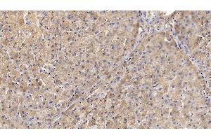 Detection of TF in Porcine Liver Tissue using Polyclonal Antibody to Transferrin (TF)
