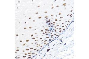 Immunohistochemistry of paraffin-embedded human esophageal using GTF2B Rabbit pAb (ABIN7267370) at dilution of 1:100 (40x lens).