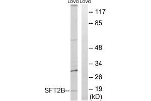 Western blot analysis of extracts from LOVO cells, using SFT2B antibody.
