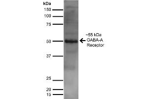 Western Blot analysis of Rat Brain showing detection of ~55 kDa GABA A Receptor Alpha 2 protein using Mouse Anti-GABA A Receptor Alpha 2 Monoclonal Antibody, Clone S399-19 . (GABRA1 Antikörper  (AA 350-385) (Atto 390))