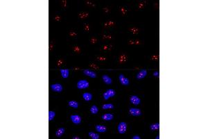 Confocal immunofluorescence analysis of U2OS cells using EBNBP2 Polyclonal Antibody (ABIN6132193, ABIN6139912, ABIN6139913 and ABIN6224909) at dilution of 1:200. (EBNA1BP2 Antikörper  (AA 1-306))