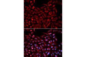 Immunofluorescence analysis of U2OS cells using NR1I3 antibody (ABIN5971021).