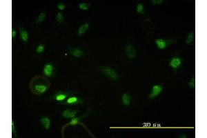 Immunofluorescence of monoclonal antibody to CBX5 on HeLa cell. (CBX5 Antikörper  (AA 1-191))